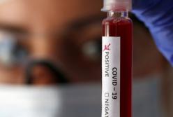 В Киеве будут тестировать на коронавирус на дому