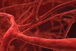 Медики рассказали, как прочистить сосуды без лекарств 
