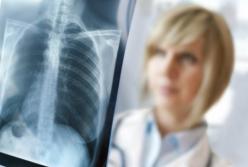 Ученые открыли механизм самоуничтожения туберкулеза