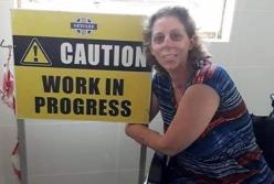 Жительница Южной Африки лишилась рук и ног из-за укуса мангуста (фото)