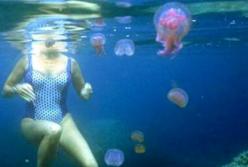 Что делать, если ужалила медуза