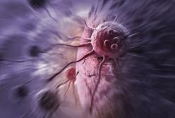 Названы продукты, которые способны снизить риск развития рака