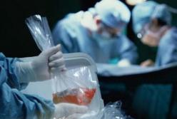 На Киевщине полиция проверяет факты незаконной трансплантации человеческих органов в частном медцентре