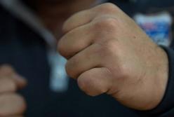 В Одесской области мужчина сломал нос продавщице цветочного магазина