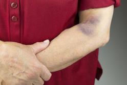 5 опасных симптомов, которые нельзя игнорировать