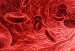 Медики нашли способ очистить кровеносные сосуды и предотвратить инсульт