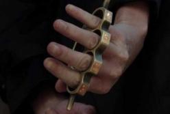 В Киеве с кастетом напали на известного юриста (фото)