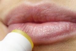 В Днепре медики спасают школьницу: пыталась сама себе увеличить губы (видео)