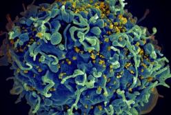 В Японии ученые успешно испытали вакцину от ВИЧ