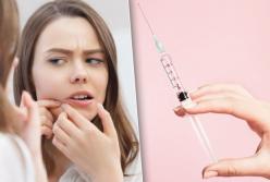 Создана прививка против прыщей