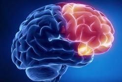 Медики объяснили, как лишний вес влияет на мозг