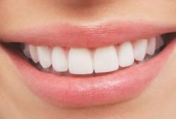 Приближение инсульта можно определить по состоянию зубов: вывод ученых