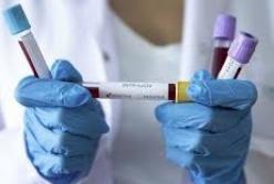 В Украине 617 новых случаев коронавируса