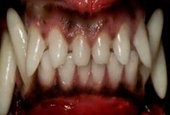 В Днепре собака разорвала ребенку лицо: фото 