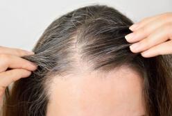 Ученые рассказали, почему люди рано седеют