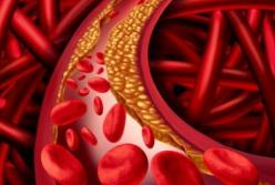 Эксперты назвали лучшие продукты для предотвращения старения сосудов