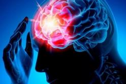 Медики назвали симптомы, предвещающие инсульт 