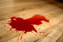 В Херсоне мужчина покончил с собой, отрезав голову электропилой