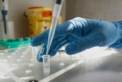 В Украине новый антирекорд по коронавирусу: 8899 случаев в сутки