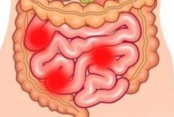 Названы продукты, которые могут вызвать непроходимость кишечника