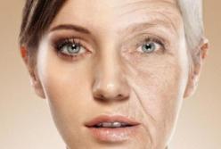 Диетологи назвали продукты, которые помогут предотвратить появление морщин