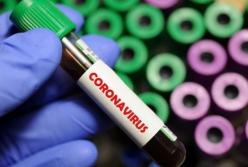 В Грузии зафиксировали первую смерть от коронавируса