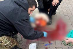 Бігла спускатися в метро: жінку з уламком в голові ушпиталили в тяжкому стані у Києві (фото, відео)