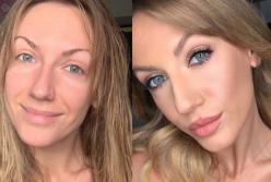 Леся Никитюк попала в больницу (фото)