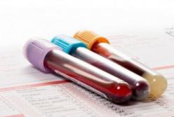 Названа болезнь, провоцирующая развитие рака