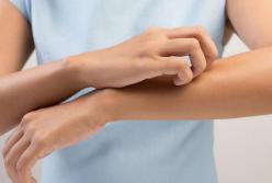 Кожный зуд: на какие расстройства в здоровье он может указывать 