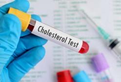 Названы три признака, указывающих на повышенный холестерин 