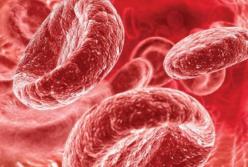 Врачи рассказали, когда снижение гемоглобина может быть признаком язвы и рака