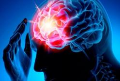 Медики назвали способы избежать инсульта