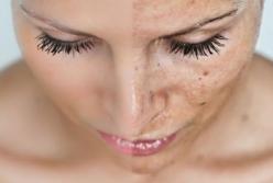 Медики рассказали, о каких проблемах со здоровьем говорит цвет кожи 