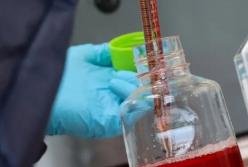 Врачи назвали неожиданный признак «тихого» рака у женщин