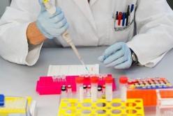 Впервые за 19 лет выявлена новая разновидность ВИЧ