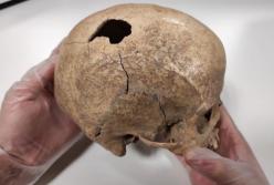 Археологи нашли останки мужчины, жившего 5 тыс. лет назад, и узнали тайну его смерти