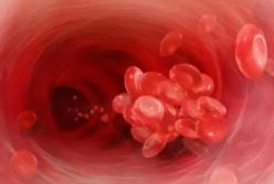 Кардиолог назвал неожиданные признаки тромбоза