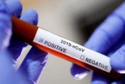 Украина получила тест-систему для выявления нового коронавируса