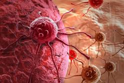 Ученые обнаружили новый способ остановить распространение рака
