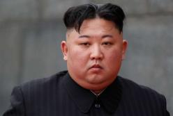 Ким Чен Ын находится в «вегетативном состоянии» — СМИ