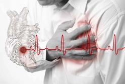 Кардиологи предупредили о скрытых признаках инфаркта