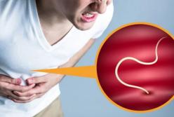 Медики назвали признаки наличия паразитов в организме