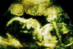 Ученые нашли микропластик в новорожденных младенцах