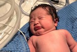 Аномальные волосы новорожденного удивили сеть (фото)