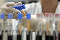 Ученые разработали анализ крови, который выявляет 50 видов рака