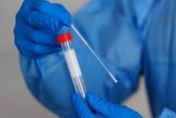 В Украине более трех тысяч новых COVID-случаев