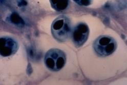 Ученые нашли животное, которое не дышит кислородом