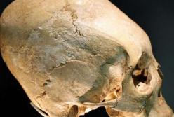 Археологи обнаружили на римском кладбище черепа необычной формы