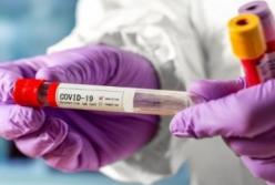 В Украине 265 новых случаев коронавируса